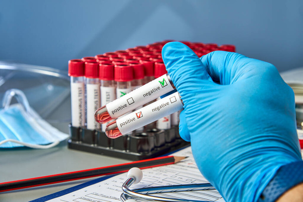 Test tubes in the doctor's hand with a positive and negative blood sample for COVID-19. Blood testing for the presence of antibodies to the causative agent of a new coronavirus infection - Foto, Imagem