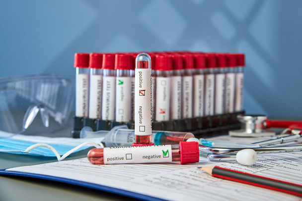 A vertical test tube with a positive blood sample for COVID-19. Blood testing for the presence of antibodies to the causative agent of a new coronavirus infection - Foto, immagini