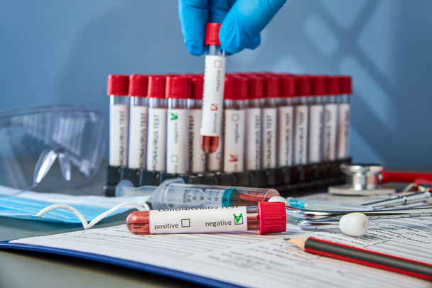 A test tube with a negative blood sample for COVID-19 against the background of vacuum tubes. Blood testing for the presence of antibodies to the causative agent of a new coronavirus infection - Zdjęcie, obraz