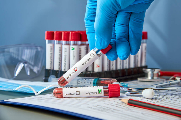 Test tubes in the doctor's hand with a positive and negative blood sample for COVID-19. Blood testing for the presence of antibodies to the causative agent of a new coronavirus infection - Foto, Imagen