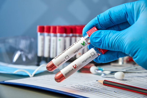 Test tubes in the doctor's hand with a positive and negative blood sample for COVID-19. Blood testing for the presence of antibodies to the causative agent of a new coronavirus infection - Foto, immagini