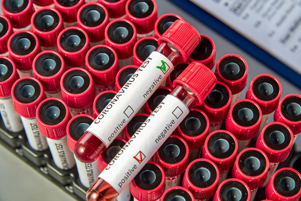 Blood test tubes for COVID-19 on vacuum tubes with blood samples. Blood test for the presence of antibodies to the causative agent of a new coronavirus infection. - Фото, изображение