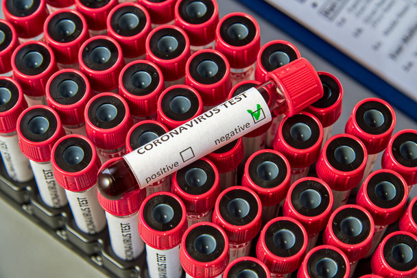 Test tube with negative blood test for COVID-19 on vacuum tubes with blood samples. Blood test for the presence of antibodies to the causative agent of a new coronavirus infection. - Fotoğraf, Görsel