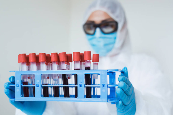 Concepto de análisis de coronavirus. Trabajador médico sosteniendo muestras de sangre en el laboratorio con prueba de Covid-19. - Foto, imagen