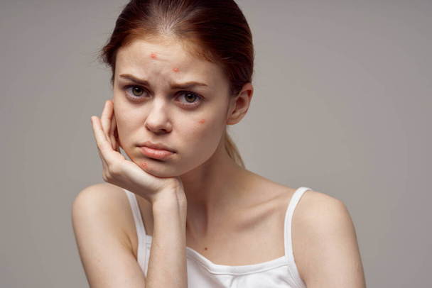 mujer piel limpia acné acné problemas de salud dermatología - Foto, Imagen