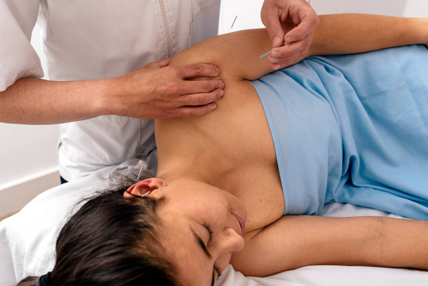 Stock photo of unrecognized worker doing acupuncture procedure to female client in shoulder. - Fotografie, Obrázek