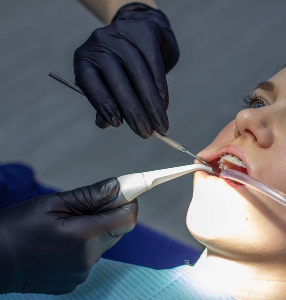 Una mujer con aparatos dentales visita a un ortodoncista en la clínica. en la silla dental durante el procedimiento de instalación de aparatos ortopédicos en los dientes superior e inferior. El dentista y el asistente trabajan juntos, tienen instrumentos dentales en sus manos. concepto de  - Foto, Imagen