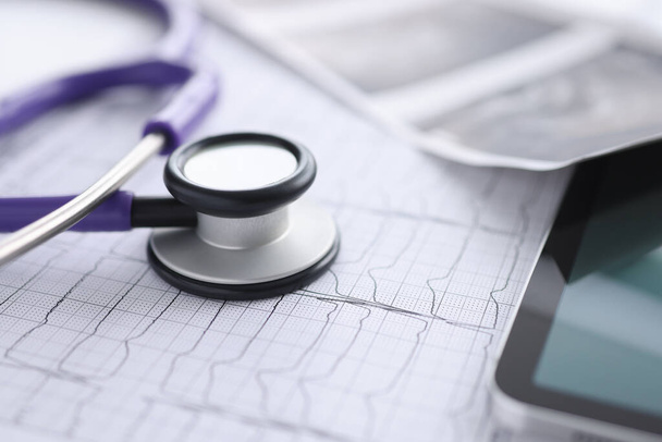 Er ligt een cardiogram tablet en stethoscoop op tafel - Foto, afbeelding