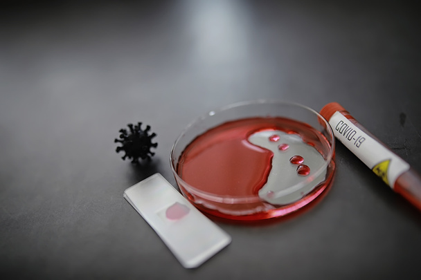 Reagenzglas mit Patientenblut zum Testen. Analyse für das Virus. Laborstudien zur Coronavirus-Pandemie. Entwicklung von Impfstoffen. - Foto, Bild