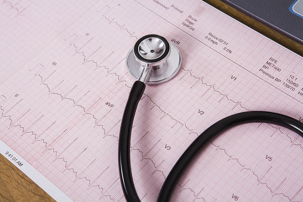 Kardiogram pulzus monitorozás és sztetoszkóp. Egészségügyi koncepció. - Fotó, kép