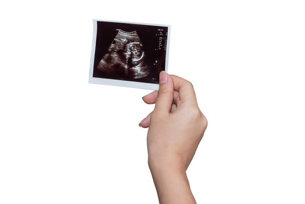 People are holding x-ray films in their hands, which are images of babies In the mother's womb On white isolated background, to pregnant and health concept. - Photo, Image