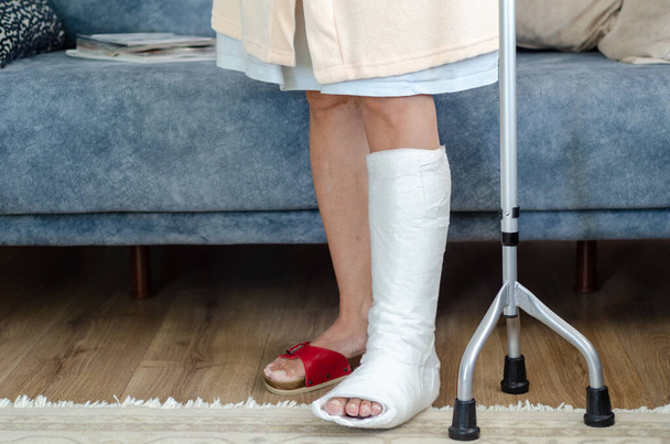 Die Frau mittleren Alters mit gebrochenem Bein steht und versucht, zu Hause zu gehen. - Foto, Bild