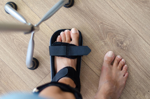 La donna con un ortopedia sul piede è in piedi a casa - Foto, immagini