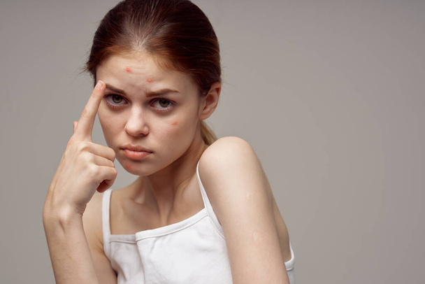 bela mulher gesticulando com as mãos perto do rosto acne problemas de pele acne - Foto, Imagem