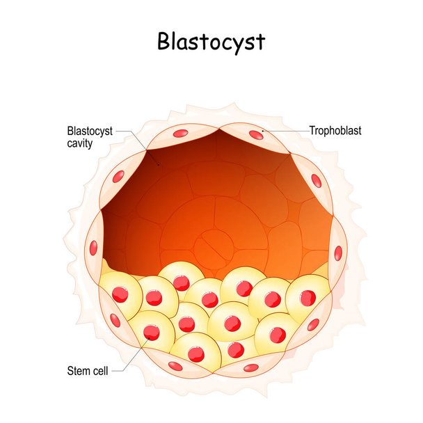 Blastocysta. Embrió fejlődési szakasz. Őssejtek. Megtermékenyítés, megtermékenyítés és terhesség. Emberi reprodukciós rendszer. Poszter tudományos, orvosi, klinikai és oktatási célokra. vektor illusztráció - Vektor, kép