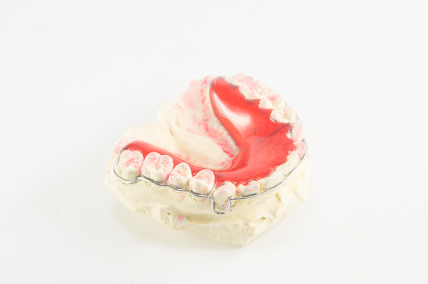 Dental brace and retainer on white background. - Photo, Image