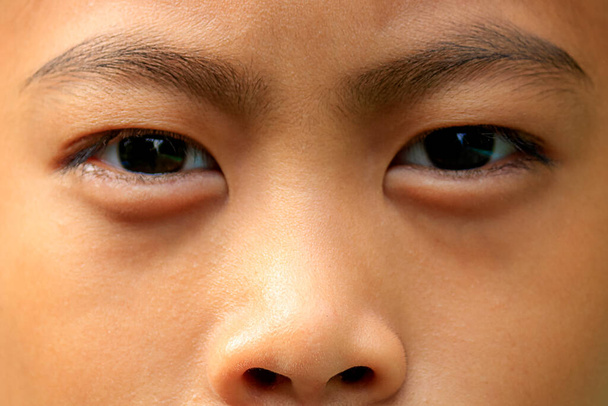 Großaufnahme eines Jungen mit Augenbrauen, Augen und Nase. - Foto, Bild