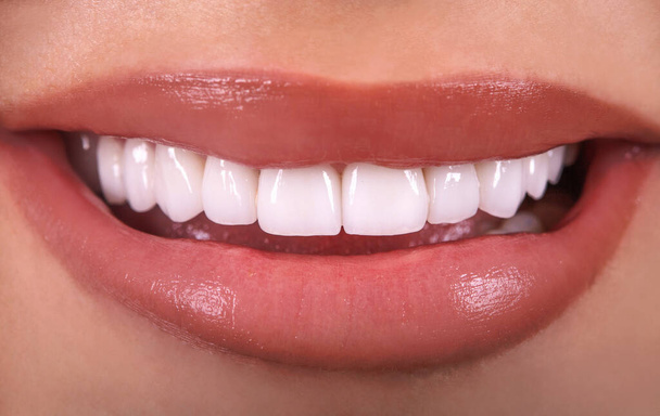 Idealne zbliżenie zmysłowe sexy uwodzicielskie pulchne usta kobieta uśmiech. Białe piękne zęby wybielanie ceramiczne korony wybielanie młoda dama uśmiechnięta. Implanty dentystyczne Chirurgia konserwatorska Koncepcja mody - Zdjęcie, obraz