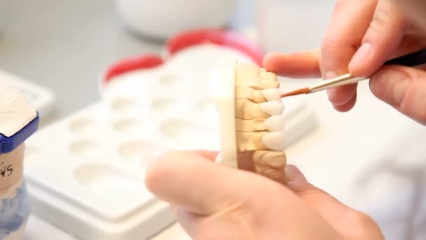 Dental dentist objects implants - Footage, Video
