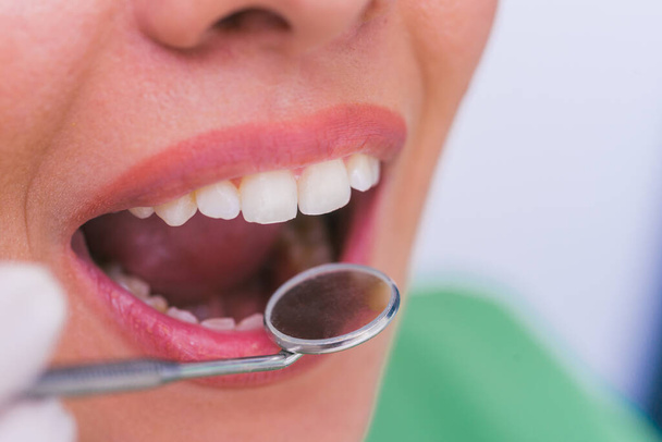 Primer plano de una paciente con la boca abierta durante el chequeo bucal en el dentista. - Foto, imagen