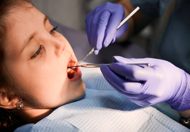 Detailní záběr pacientky s otevřenou pusou, zatímco zubař kontroluje dětské zuby. Stomatolog zkoumá dětské zuby se zubním průzkumníkem a zrcadlem. Koncepce pediatrické stomatologie a zubní péče. - Fotografie, Obrázek