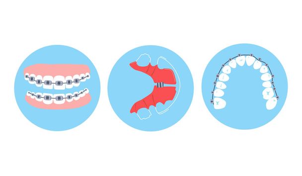 Dental braces, aligner or orthodontic metal retainers on teeth.Oral care and daily routine.Bite correction. Different projections.International day of the dentist.Vector in flat style.Cavity disease - Vector, Image