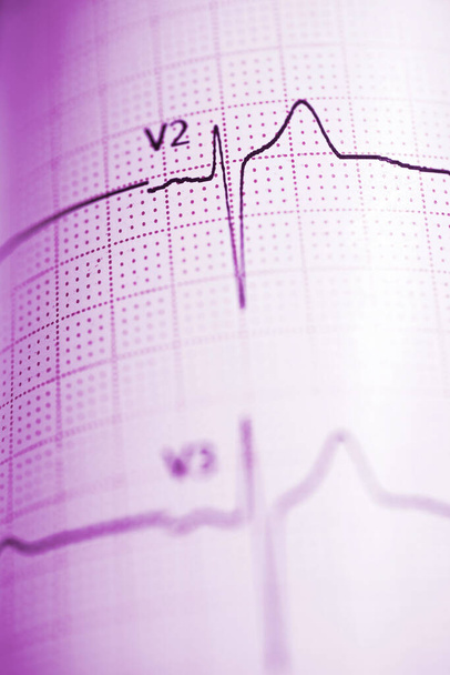 Gros plan d'un électrocardiogramme sur papier. - Photo, image