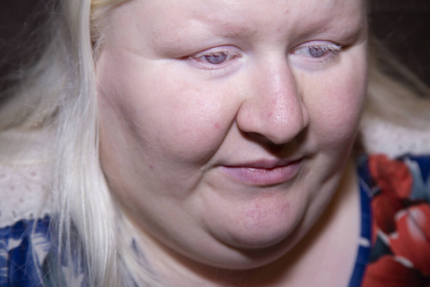 Extremo primer plano de una triste mujer albina - Foto, Imagen