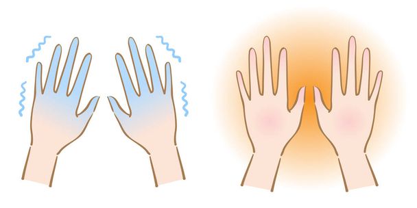 mani fredde e calde.Parte del corpo umano. concetto di assistenza sanitaria - Vettoriali, immagini