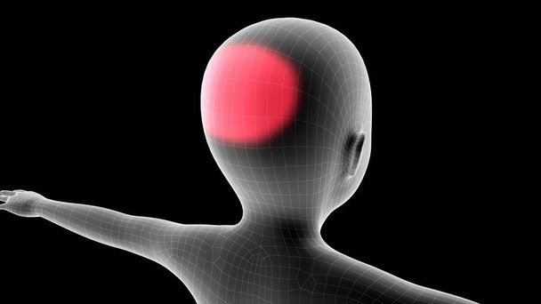 Illustrazione 3D di un ologramma a raggi X per bambini che mostra l'area del dolore sulla zona della testa - Foto, immagini