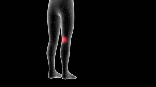 3d ілюстрація дитячої рентгенівської голограми, що показує ділянку болю на ділянці ноги
 - Фото, зображення