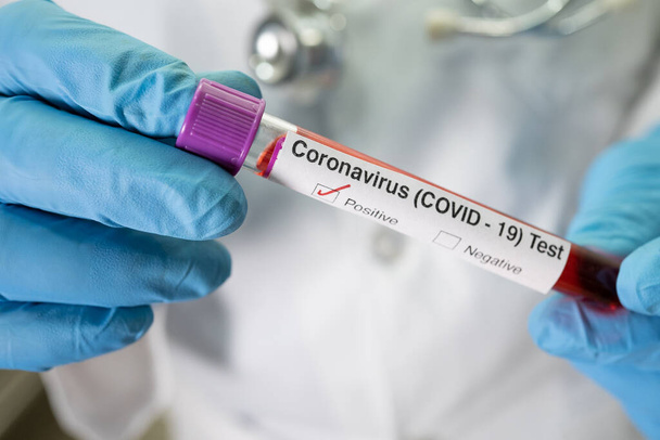 Positive blood infection sample in test tube for covid-19 coronavirus in lab. Scientist holding to check and analyze for patient in hospital. - Photo, Image