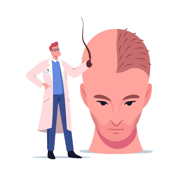 El pequeño personaje del doctor que sostiene el folículo prepara la cabeza masculina enorme para el procedimiento del trasplante de pelo, cirugía plástica - Vector, imagen