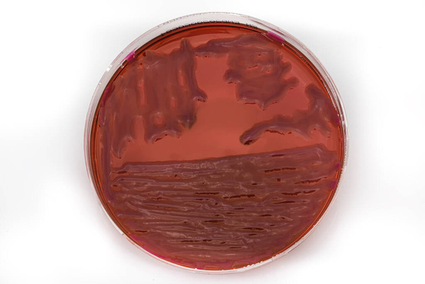 Baktériumok termesztése agar táptalajban a mikrobiológiai laborban. Hogy csík egy Petri-csészében elszigetelt fehér háttérrel. Baktériumkolóniák keveréke Petri-csészében. - Fotó, kép