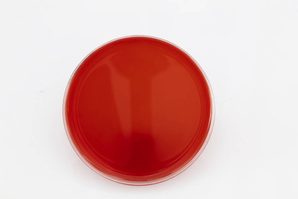 Wachsende Bakterien im Agar-Medium im mikrobiologischen Labor. Streifen in einer Petrischale isoliert auf weißem Hintergrund. Bakterienkolonien in Petrischale gemischt. - Foto, Bild