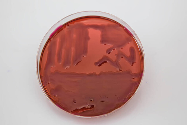 Crecimiento de bacterias en medio agar en laboratorio de microbiología. Haciendo rayas en una placa de Petri aislada sobre fondo blanco. Mezcla de colonias bacterianas en placas de Petri. - Foto, Imagen