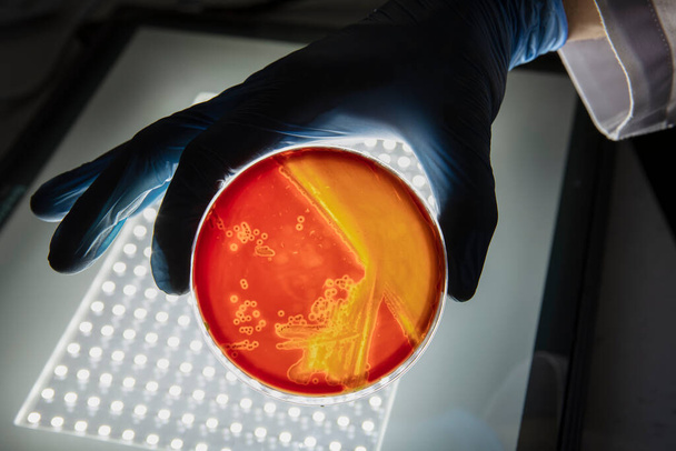 Crecimiento de bacterias en medio agar en laboratorio de microbiología. Haciendo rayas en una placa de Petri aislada sobre fondo blanco. Mezcla de colonias bacterianas en placas de Petri. - Foto, Imagen