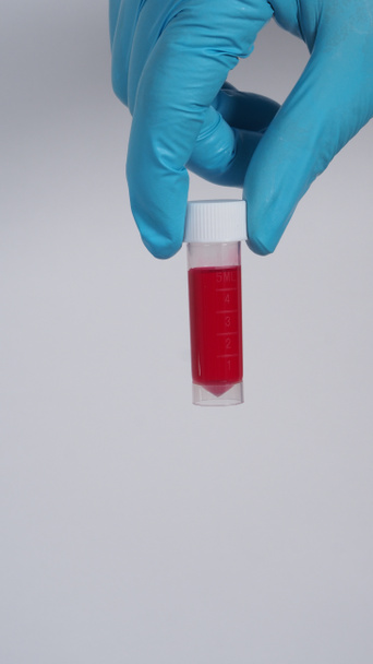 血液管だ。コヴィッド19テスト。手先生が血液サンプルチューブを持って研究室の背景で分析しています。医療用手袋の技術者は、感染したウイルスを保護するための研究ワクチンのための血液チューブテストを保持する。CU分離ショット - 写真・画像
