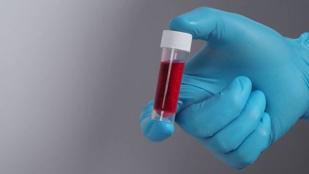 Kan tüpü. Covid 19 Testi. Doktor el, laboratuvar geçmişinde analiz için kan örneği tüpü tutuyor. Tıbbi eldivenli teknisyen virüs bulaşmış virüsü korumak için kan tüpü testi yapıyor. CU izole atış - Fotoğraf, Görsel