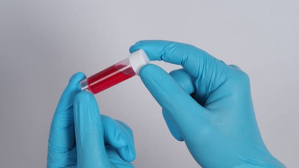Vércső. Covid 19 teszt. orvos kéz kezében egy vérminta cső elemzésre a laboratóriumi háttérben. Orvosi kesztyűben lévő technikus, aki vércső tesztet tart a vírusfertőzöttek védelme érdekében. CU izolált lövés - Fotó, kép