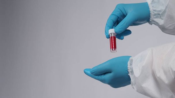 血液管だ。コヴィッド19テスト。手先生が血液サンプルチューブを持って研究室の背景で分析しています。医療用手袋の技術者は、感染したウイルスを保護するための研究ワクチンのための血液チューブテストを保持する。CU分離ショット - 写真・画像