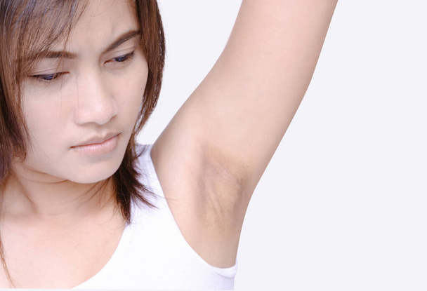Frauen Problem schwarze Achselhöhle auf weißem Hintergrund für Hautpflege und Schönheitskonzept - Foto, Bild