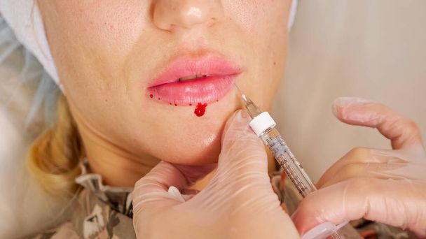 Profissional cirurgião cosmético injeta mulher madura lábio perto - Foto, Imagem