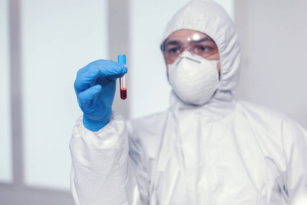Nahaufnahme von mit Coronavirus infiziertem Blut im Reagenzglas - Foto, Bild