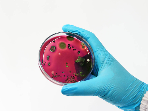 Test scientifici Escherichia coli (E.coli) coltura con Eosina Metilene Blu (EMB) Agar in piatto di Petri mostrano la colonia di lucentezza verde metallizzato, tenere in mano con guanti di nitrile isolati in fondo bianco. - Foto, immagini