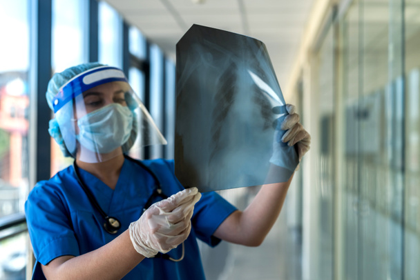 junge Krankenschwester in blauer Uniform mit Schutzmaske und Gesichtsschutz betrachtet das Ergebnis der Lungenfluorographie - Foto, Bild