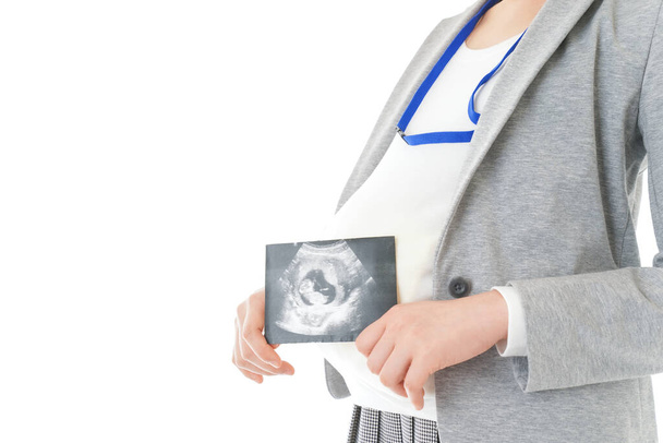 Pregnant woman with echo image of baby - Фото, зображення