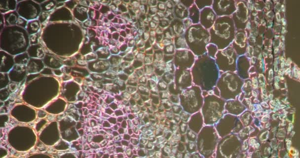 Poisson borostyán szár a Darkfield szövet mikroszkóp alatt 200x - Felvétel, videó