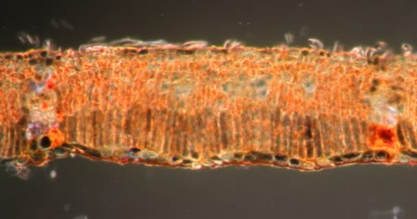 Плакуча верба в тканинах Даркфілда під мікроскопом 200x - Кадри, відео