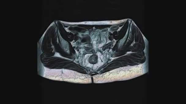 Resonancia magnética multicolor a granel de los órganos pélvicos femeninos, cavidad abdominal, tracto gastrointestinal y vejiga - Metraje, vídeo